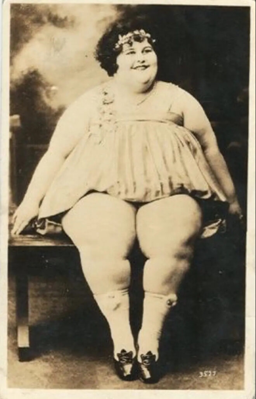 The story of strong-willed circus performer Dolly Dimples, who became famous first for gaining weight and then for losing it