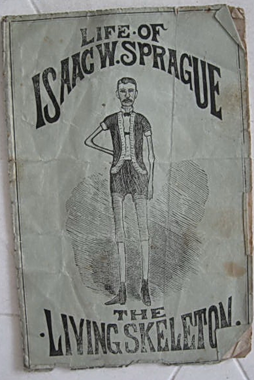 The Tragic Story of the "Living Skeleton" Isaac Sprague The Tragic Story of the "Living Skeleton" Isaac Sprague