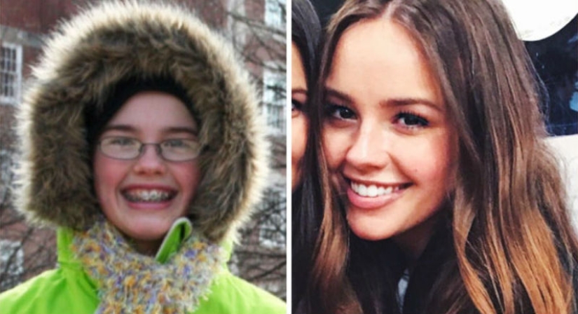 Time is the best photoshop, netizens showed how they have changed with age