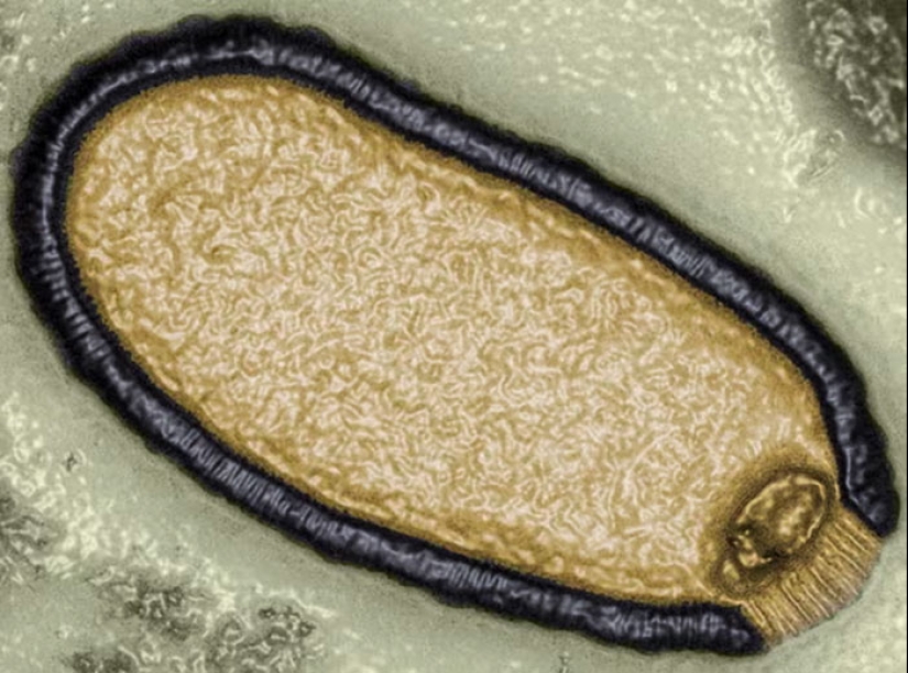 “We Face A Tangible Threat”: Scientists Speak About “Zombie Viruses” That Could Spark Pandemic “We Face A Tangible Threat”: Scientists Speak About “Zombie Viruses” That Could Spark Pandemic