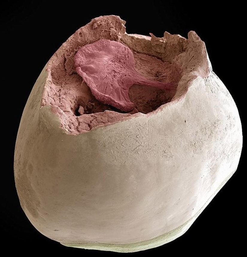 What's in your mouth, close-up