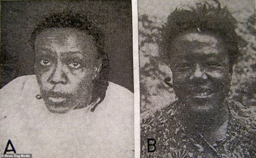 Without the past and the future: treatment of lobotomy from mental disorders Without the past and the future: treatment of lobotomy from mental disorders