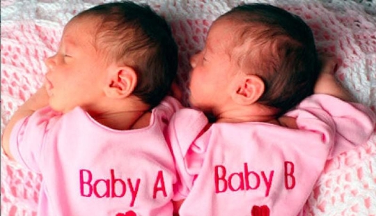 10 incredible true stories about twins