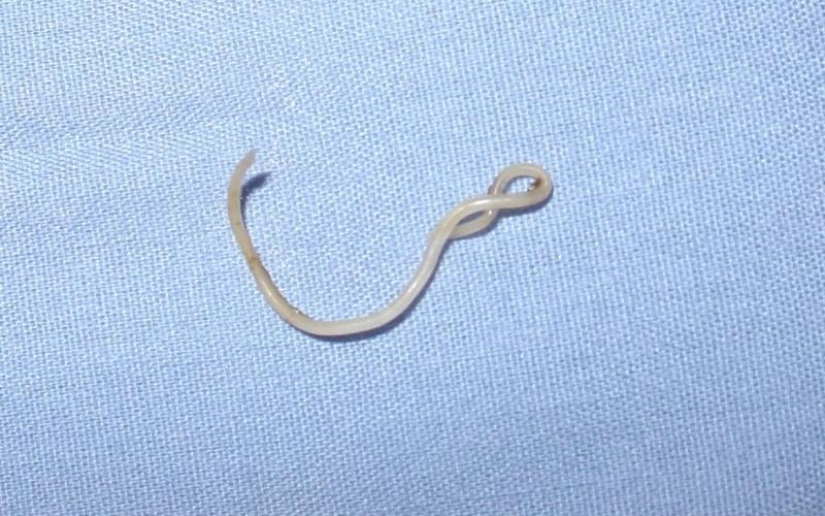 10 parasites to watch out for in summer 10 parasites to watch out for in summer