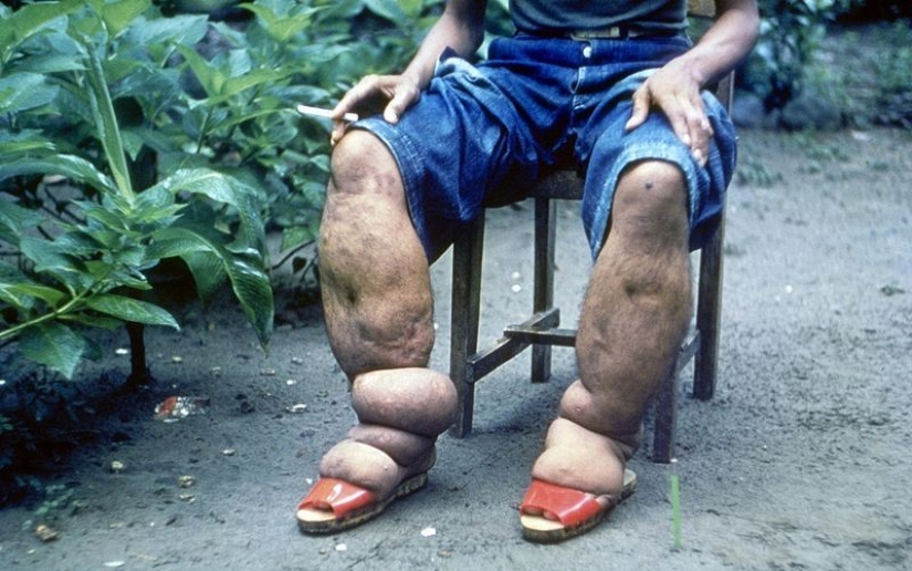 10 parasites to watch out for in summer 10 parasites to watch out for in summer