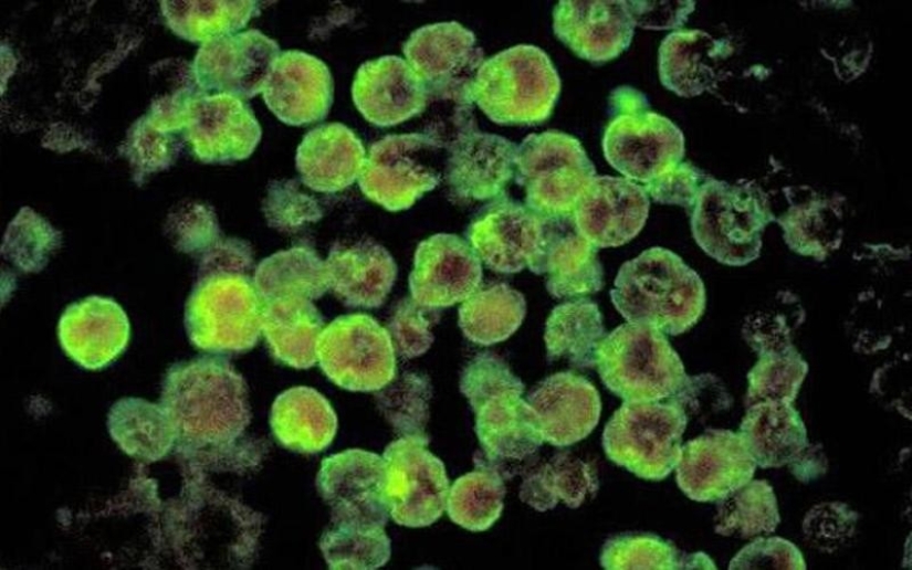 10 parasites to watch out for in summer 10 parasites to watch out for in summer