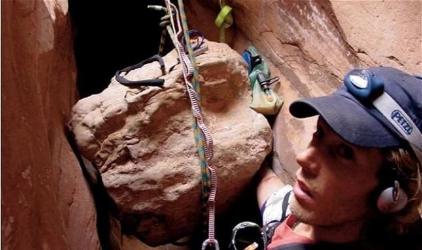 10 situaciones extremas en las que una extremidad tuvo que ser amputada independientemente para sobrevivir