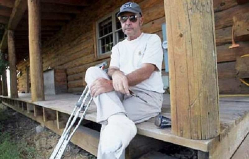 10 situaciones extremas en las que una extremidad tuvo que ser amputada independientemente para sobrevivir