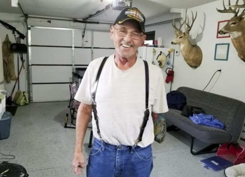 10 situaciones extremas en las que una extremidad tuvo que ser amputada independientemente para sobrevivir