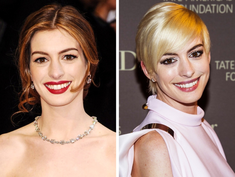 15 cases, when the star decided to change the image, but something went wrong 15 cases, when the star decided to change the image, but something went wrong