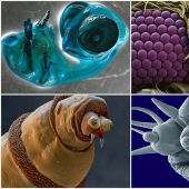 15 criaturas asombrosas que no se pueden ver sin un microscopio
