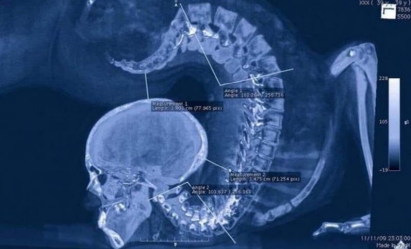 15 muy extraño y espeluznante fotos de las cosas reales 15 muy extraño y espeluznante fotos de las cosas reales