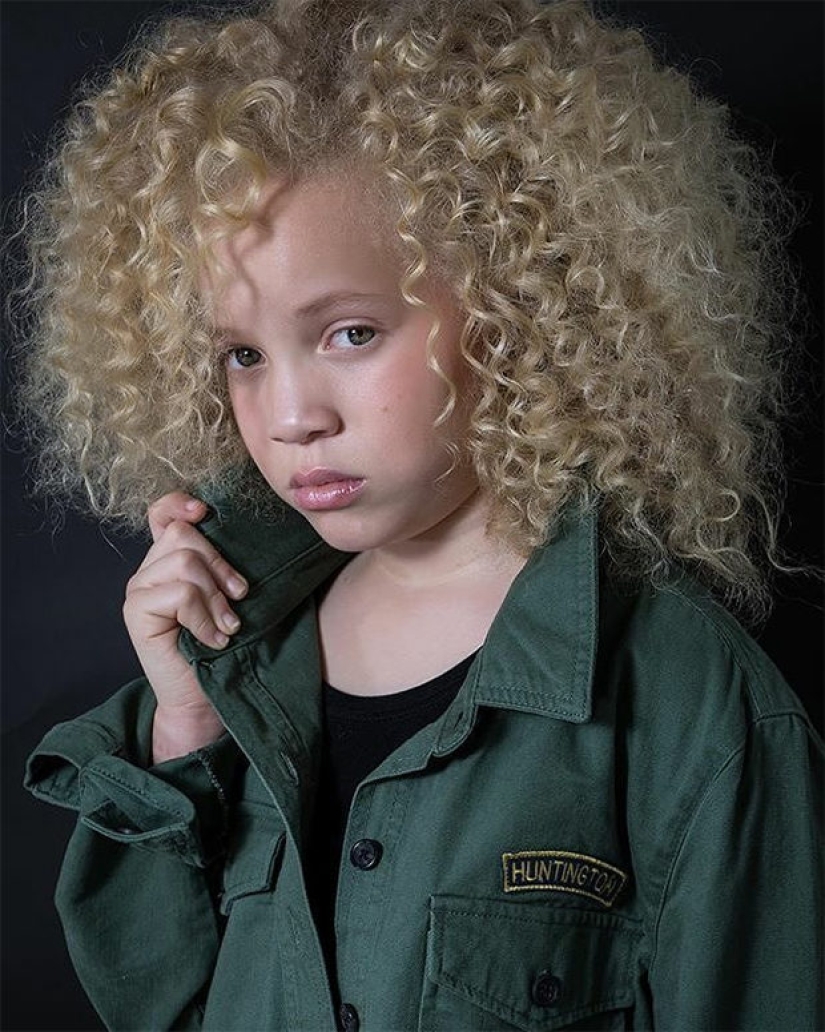 15 people and animals, who won the genetic lottery 15 people and animals, who won the genetic lottery