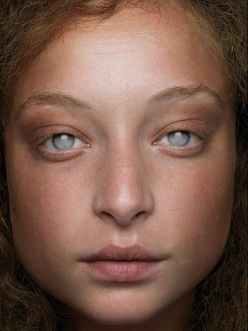 15 people and animals, who won the genetic lottery 15 people and animals, who won the genetic lottery