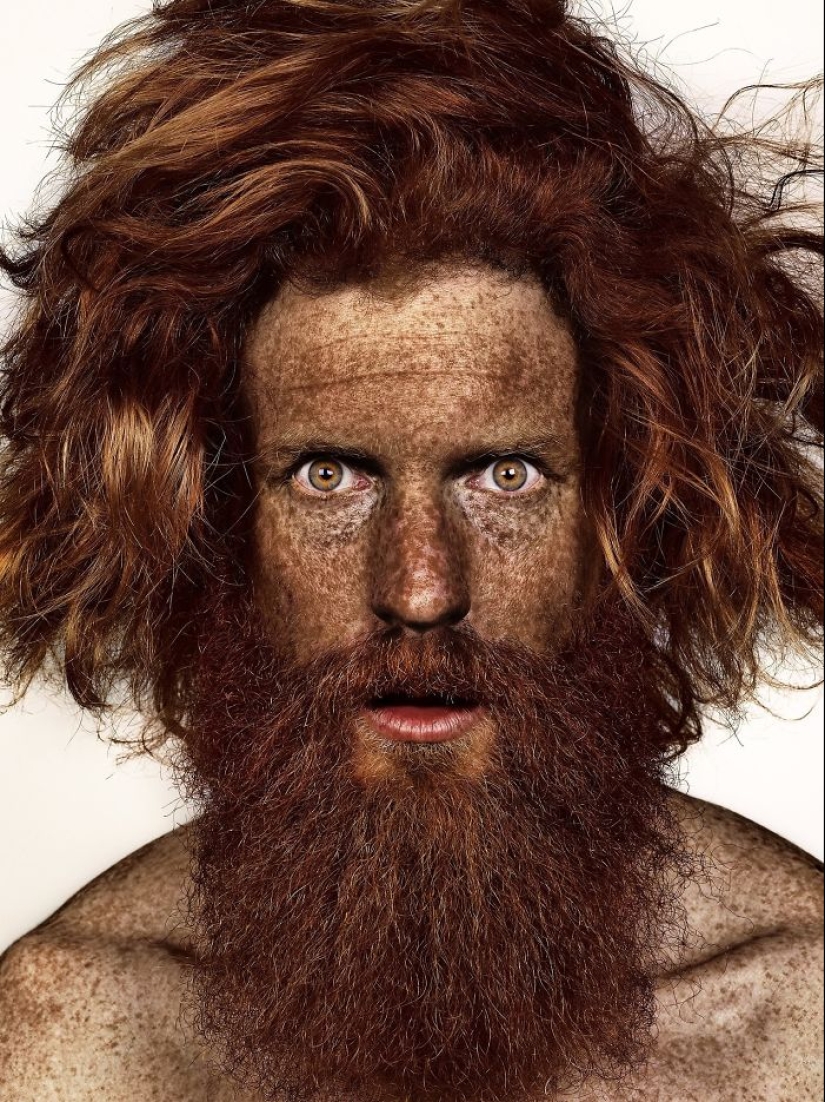 16 fascinantes fotos de personas con pecas 16 fascinantes fotos de personas con pecas