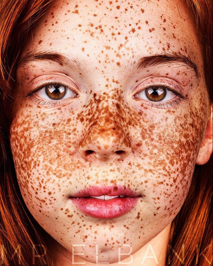 16 fascinantes fotos de personas con pecas 16 fascinantes fotos de personas con pecas