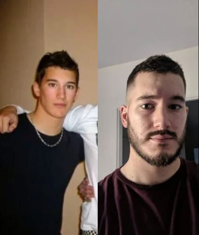 16 transformaciones sorprendentes de las personas: en la adolescencia y ahora 16 transformaciones sorprendentes de las personas: en la adolescencia y ahora
