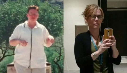 16 transformaciones sorprendentes de las personas: en la adolescencia y ahora 16 transformaciones sorprendentes de las personas: en la adolescencia y ahora