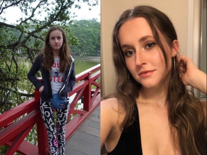 16 transformaciones sorprendentes de las personas: en la adolescencia y ahora 16 transformaciones sorprendentes de las personas: en la adolescencia y ahora