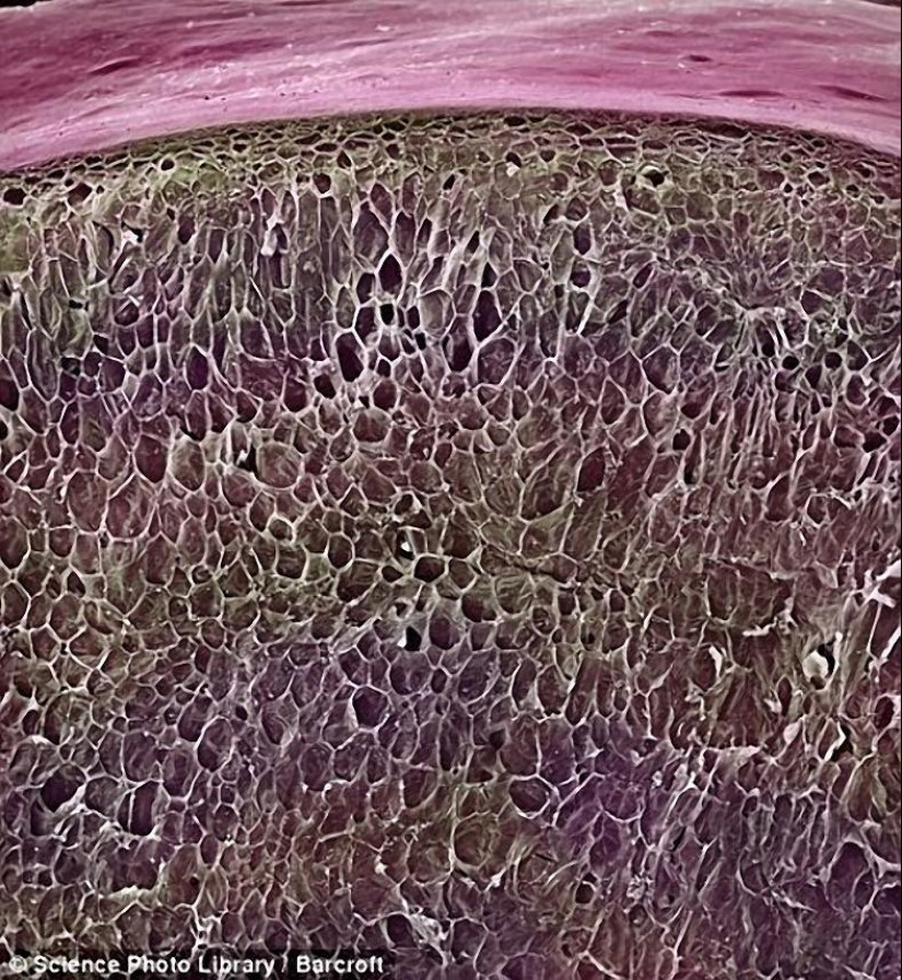 18 amazing photos of products under the microscope