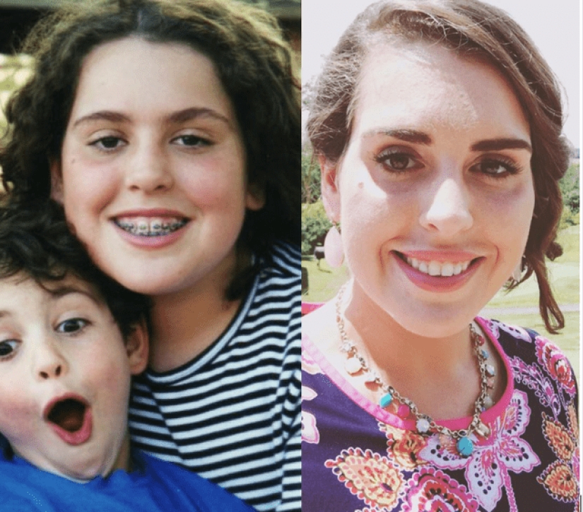 18 "patitos feos" que se han convertido en "hermosos cisnes" 18 "patitos feos" que se han convertido en "hermosos cisnes"