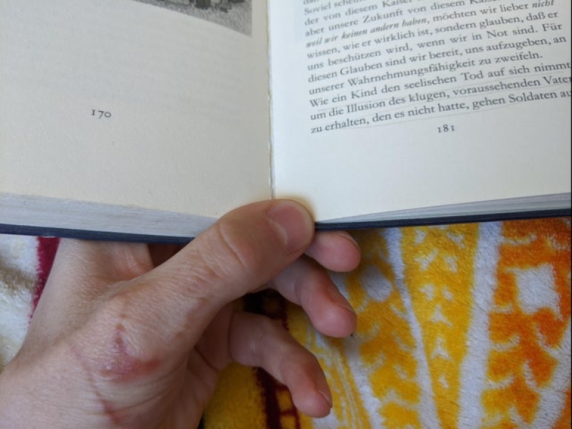 18 personas que saben mejor que nadie que esa "mala suerte"