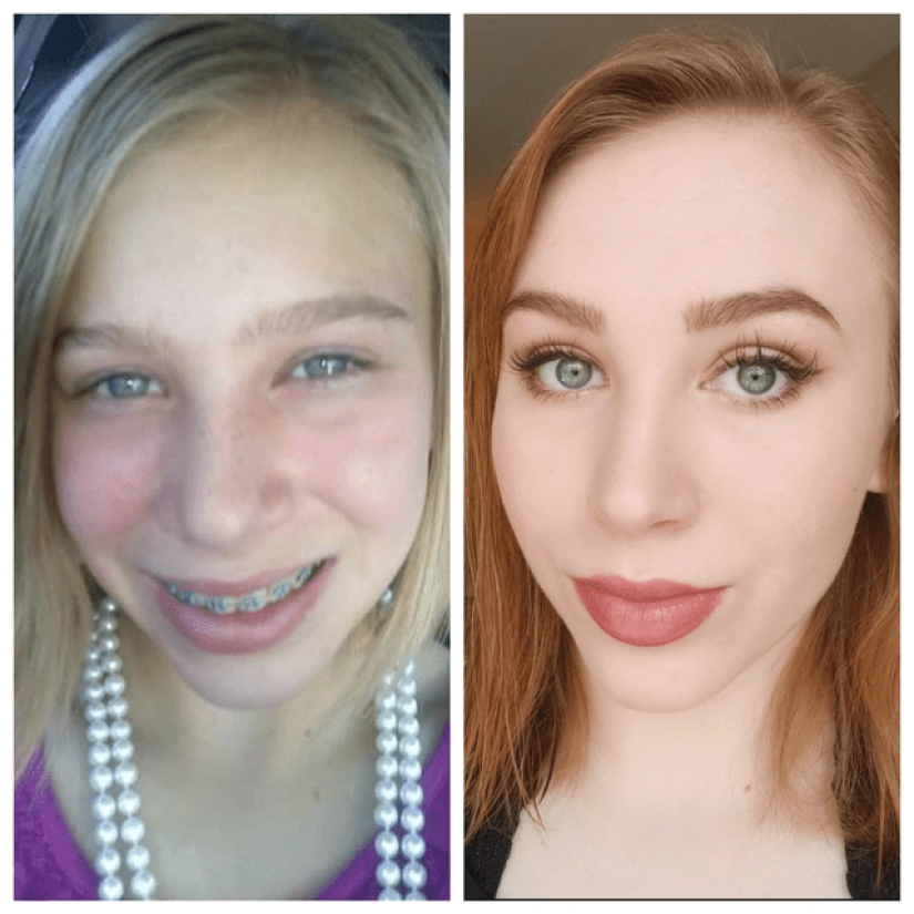 18 "ugly ducklings" that have become "beautiful swans" 18 "ugly ducklings" that have become "beautiful swans"