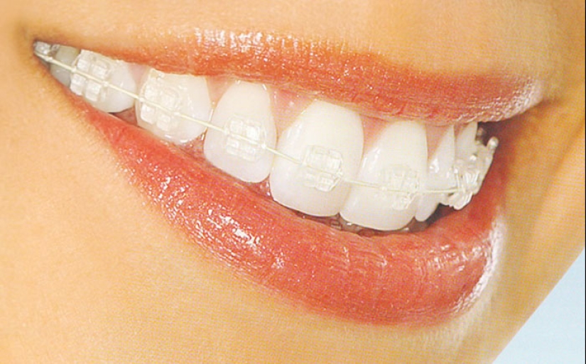 20 Amazing NASA Inventions That Dramatically Changed Everyday Life