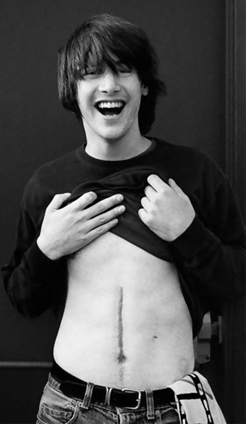 20 historias de la aparición de cicatrices en estrellas rusas y extranjeras 20 historias de la aparición de cicatrices en estrellas rusas y extranjeras