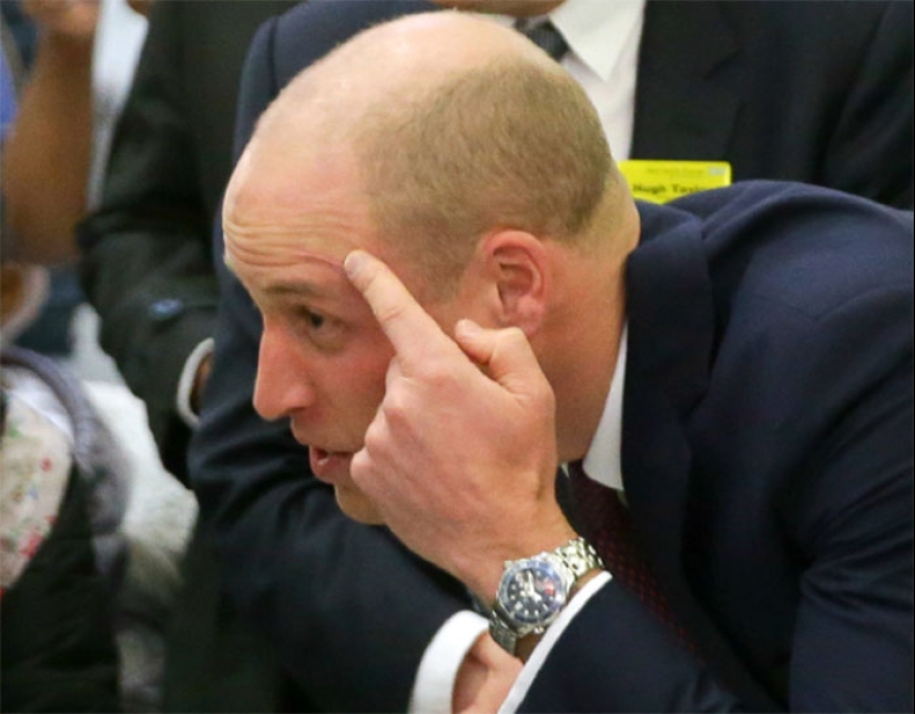 20 historias de la aparición de cicatrices en estrellas rusas y extranjeras 20 historias de la aparición de cicatrices en estrellas rusas y extranjeras