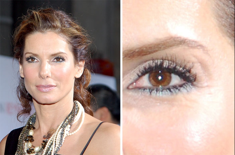 20 historias de la aparición de cicatrices en estrellas rusas y extranjeras 20 historias de la aparición de cicatrices en estrellas rusas y extranjeras