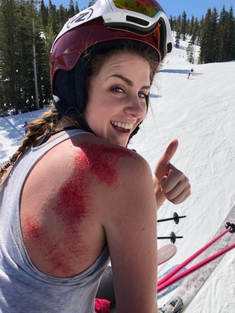 20+ personas que sintieron lo que es un mal día, en su propia piel 20+ personas que sintieron lo que es un mal día, en su propia piel