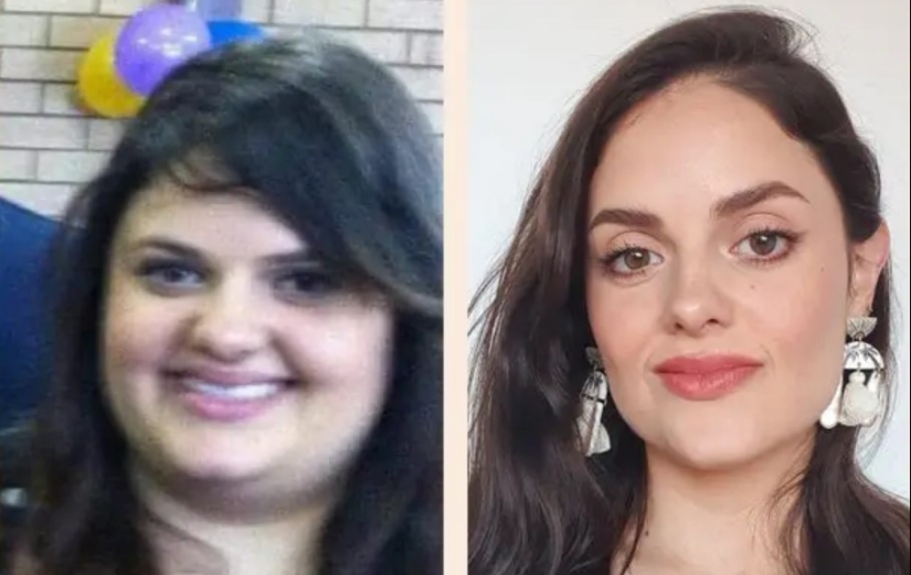 20 photos of "ugly ducklings" that became " beautiful swans» 20 photos of "ugly ducklings" that became " beautiful swans»