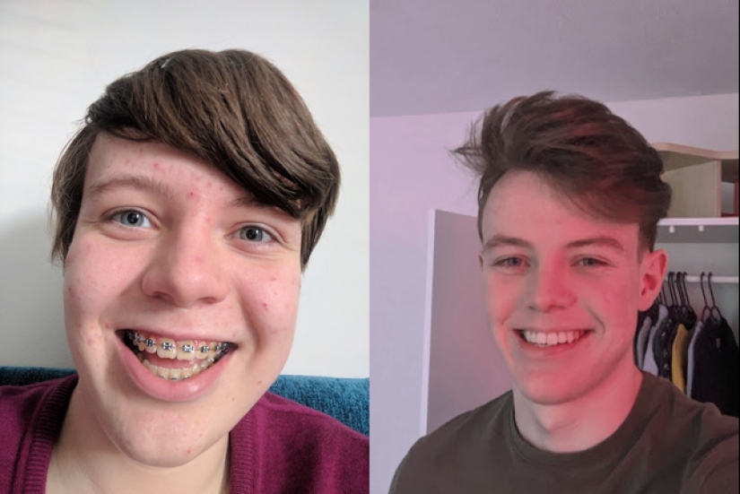 20 photos of "ugly ducklings" that became " beautiful swans» 20 photos of "ugly ducklings" that became " beautiful swans»