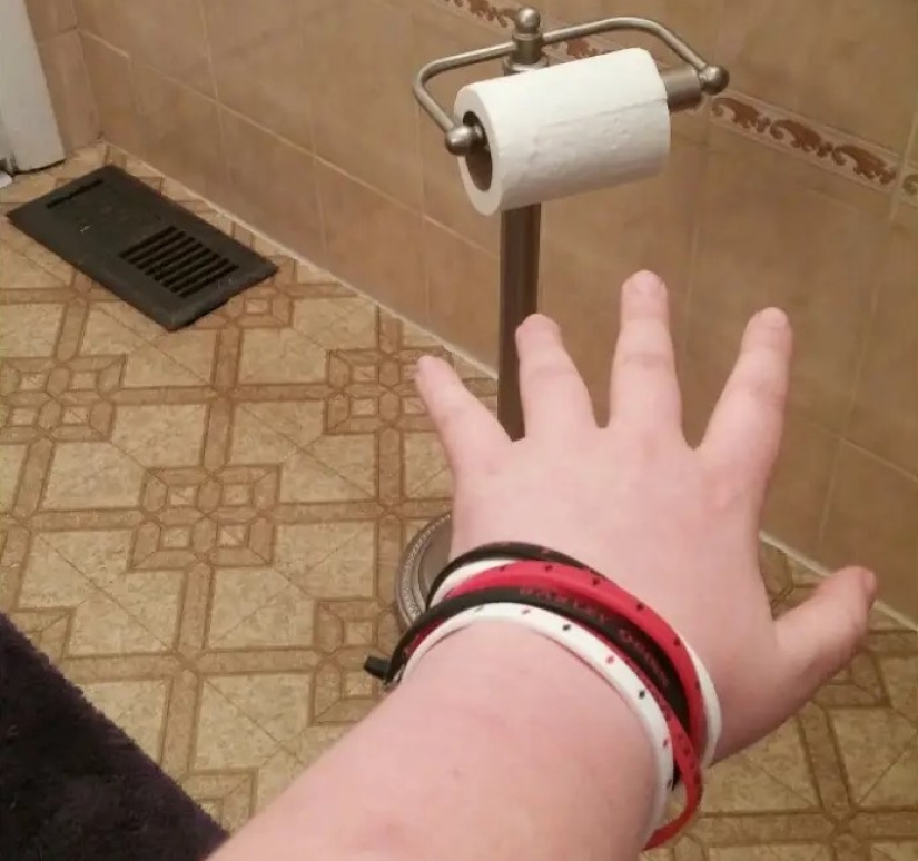 20 photos that show all the suffering of people of low stature