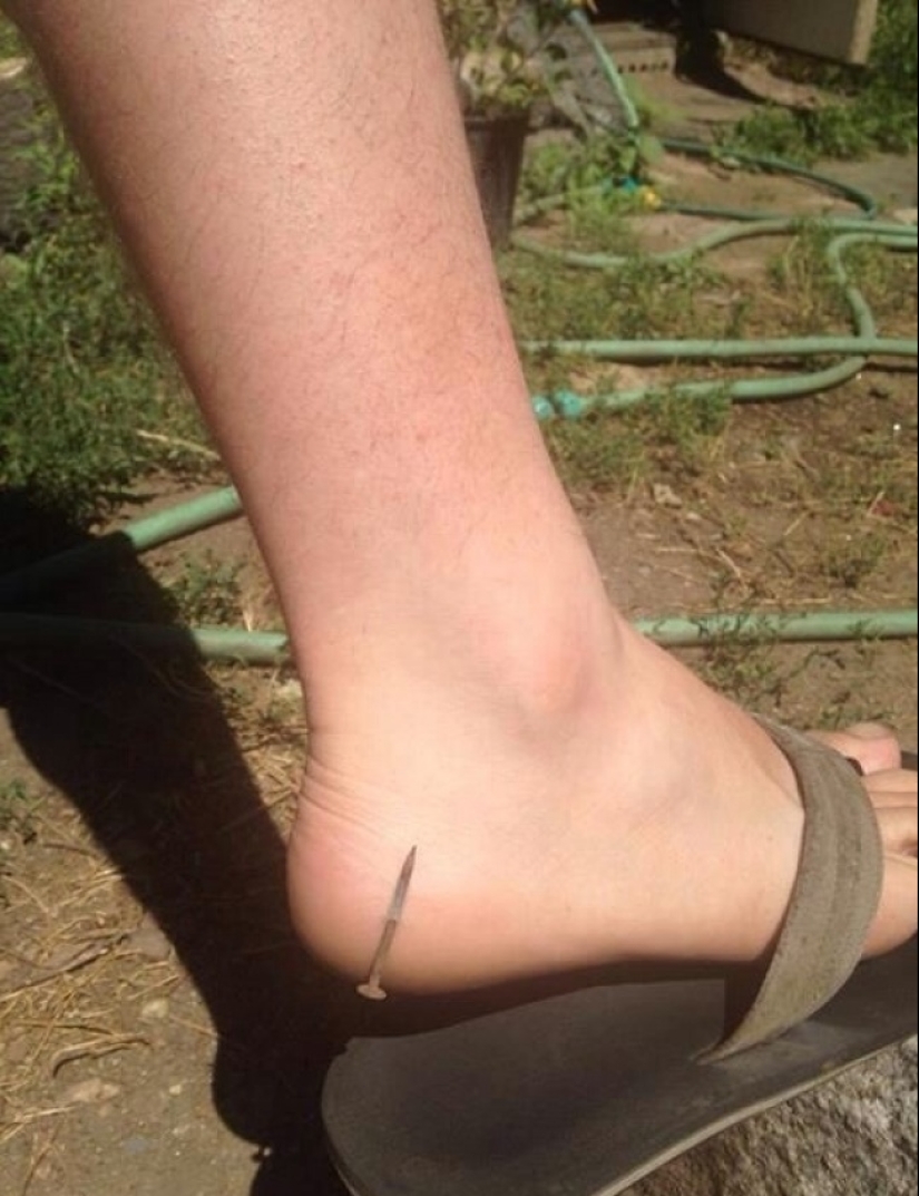 22 cases of incredible luck