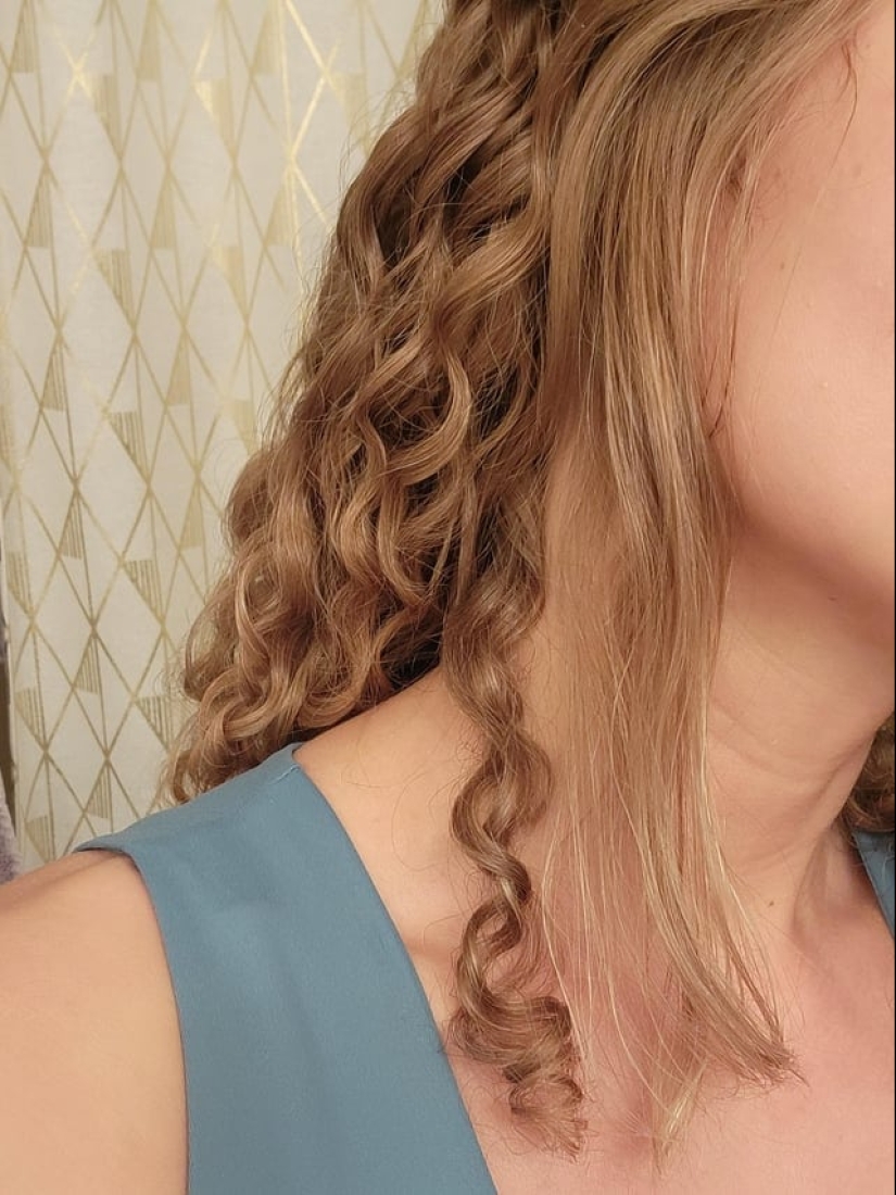 22 ejemplos en los que un mal funcionamiento de los genes dio a las personas un chip de apariencia único