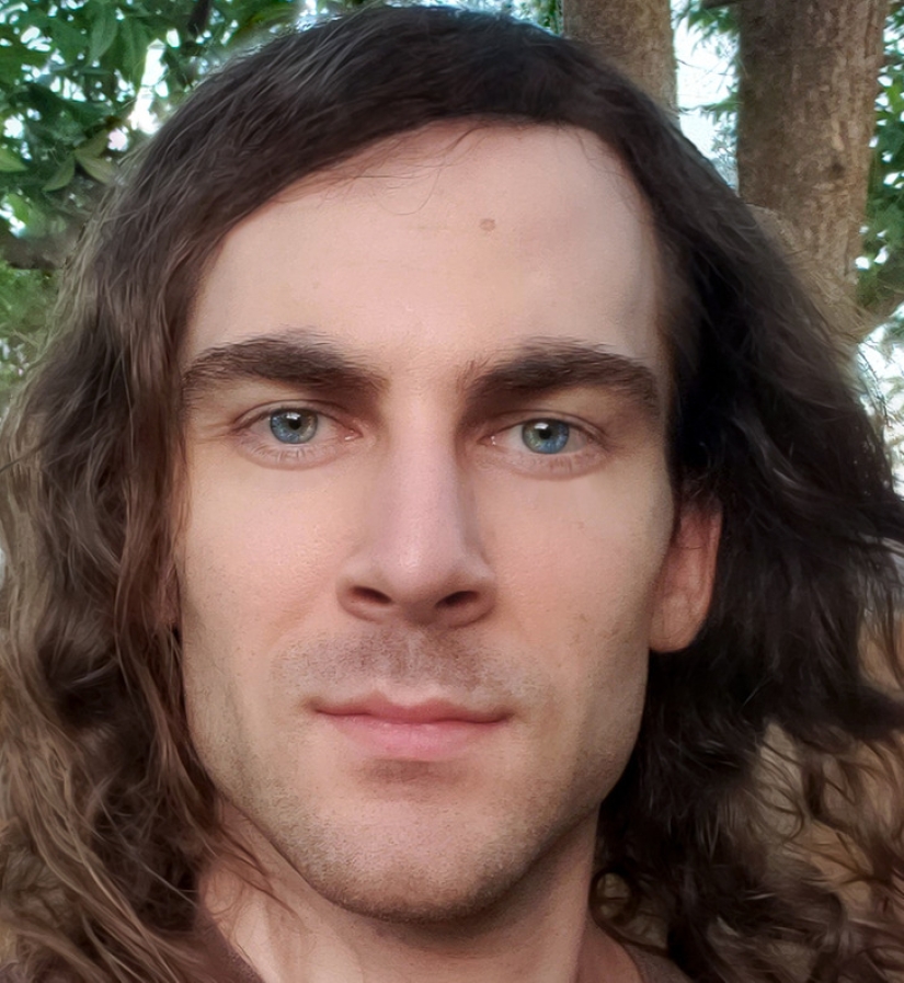 22 ejemplos en los que un mal funcionamiento de los genes dio a las personas un chip de apariencia único