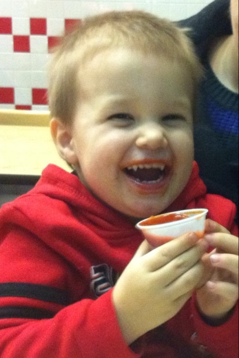 22 ejemplos en los que un mal funcionamiento de los genes dio a las personas un chip de apariencia único