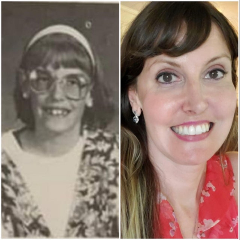 22 examples of how "ugly ducklings" became real handsome