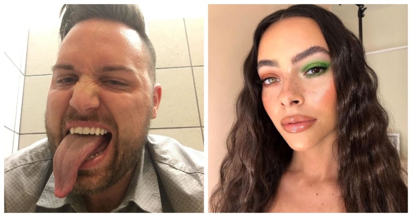 22 examples when a gene malfunction gave people a unique appearance chip 22 examples when a gene malfunction gave people a unique appearance chip