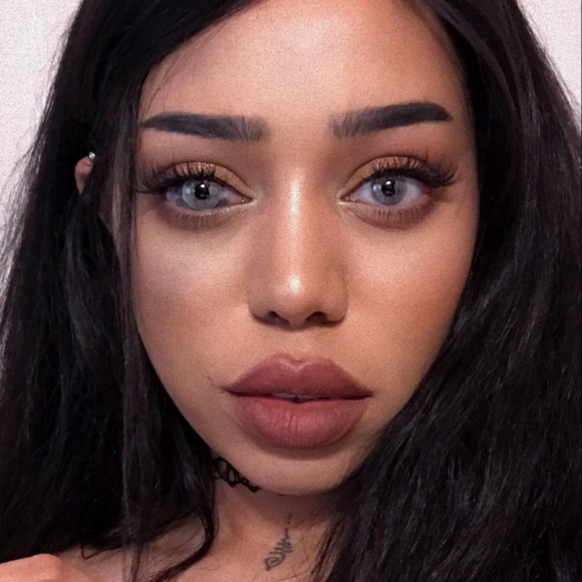 22 examples when a gene malfunction gave people a unique appearance chip 22 examples when a gene malfunction gave people a unique appearance chip