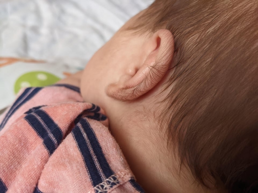 22 examples when a gene malfunction gave people a unique appearance chip 22 examples when a gene malfunction gave people a unique appearance chip