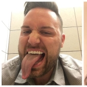 22 examples when a gene malfunction gave people a unique appearance chip