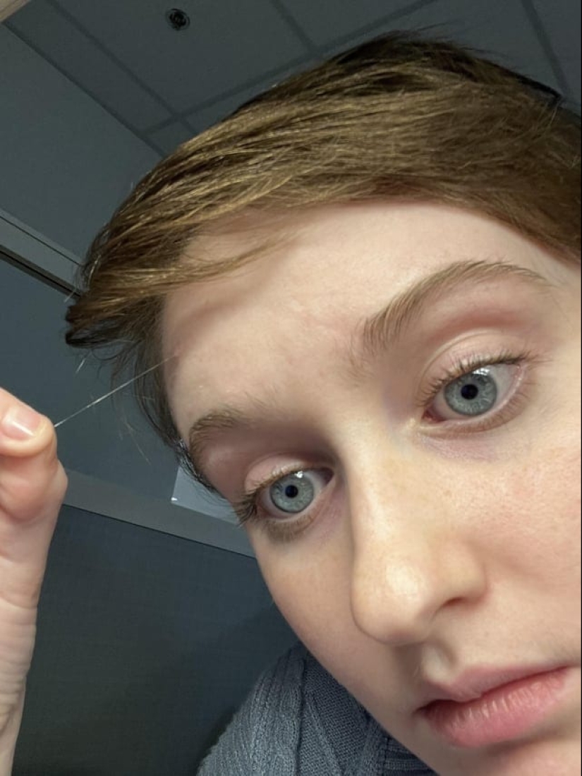 22 examples when a gene malfunction gave people a unique appearance chip 22 examples when a gene malfunction gave people a unique appearance chip