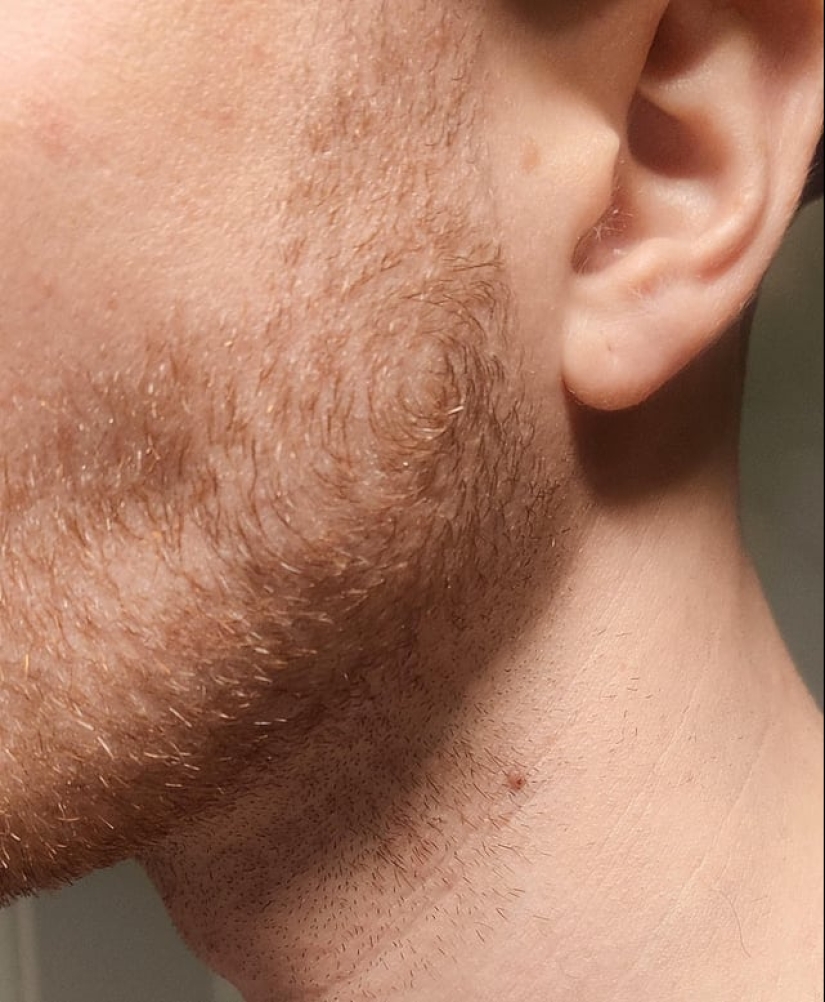 22 examples when a gene malfunction gave people a unique appearance chip 22 examples when a gene malfunction gave people a unique appearance chip