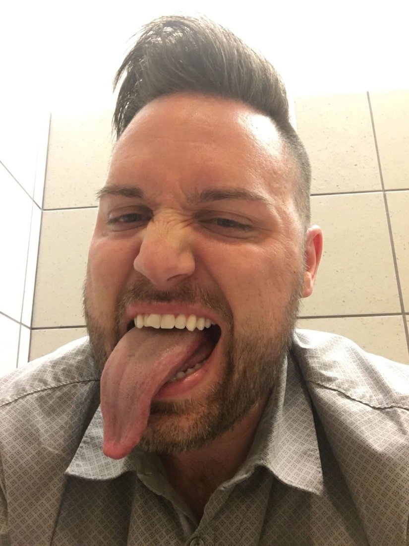 22 examples when a gene malfunction gave people a unique appearance chip 22 examples when a gene malfunction gave people a unique appearance chip