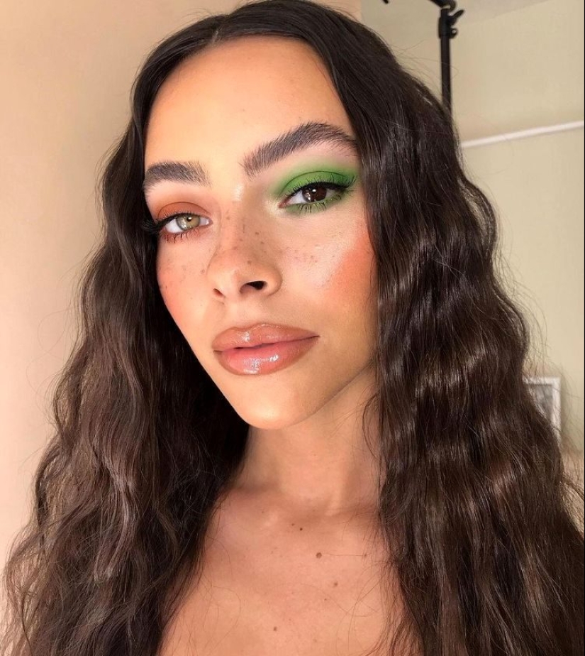 22 examples when a gene malfunction gave people a unique appearance chip 22 examples when a gene malfunction gave people a unique appearance chip