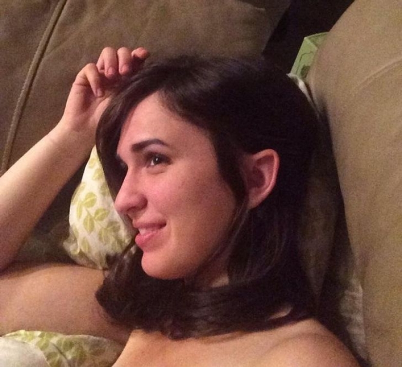 22 examples when a gene malfunction gave people a unique appearance chip 22 examples when a gene malfunction gave people a unique appearance chip