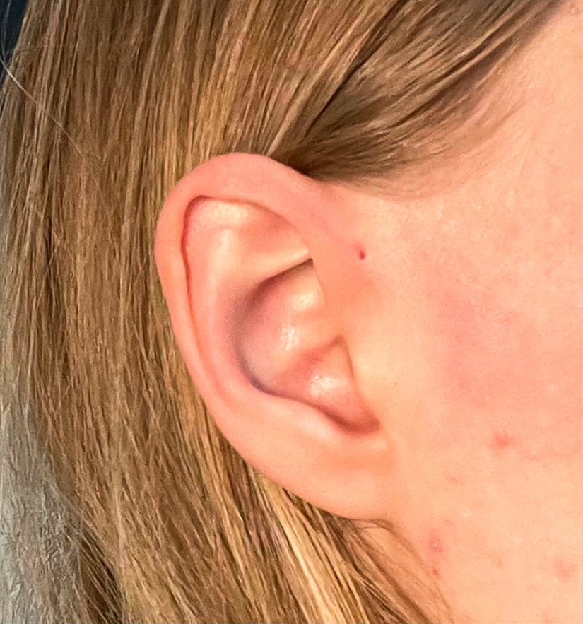 22 examples when a gene malfunction gave people a unique appearance chip 22 examples when a gene malfunction gave people a unique appearance chip